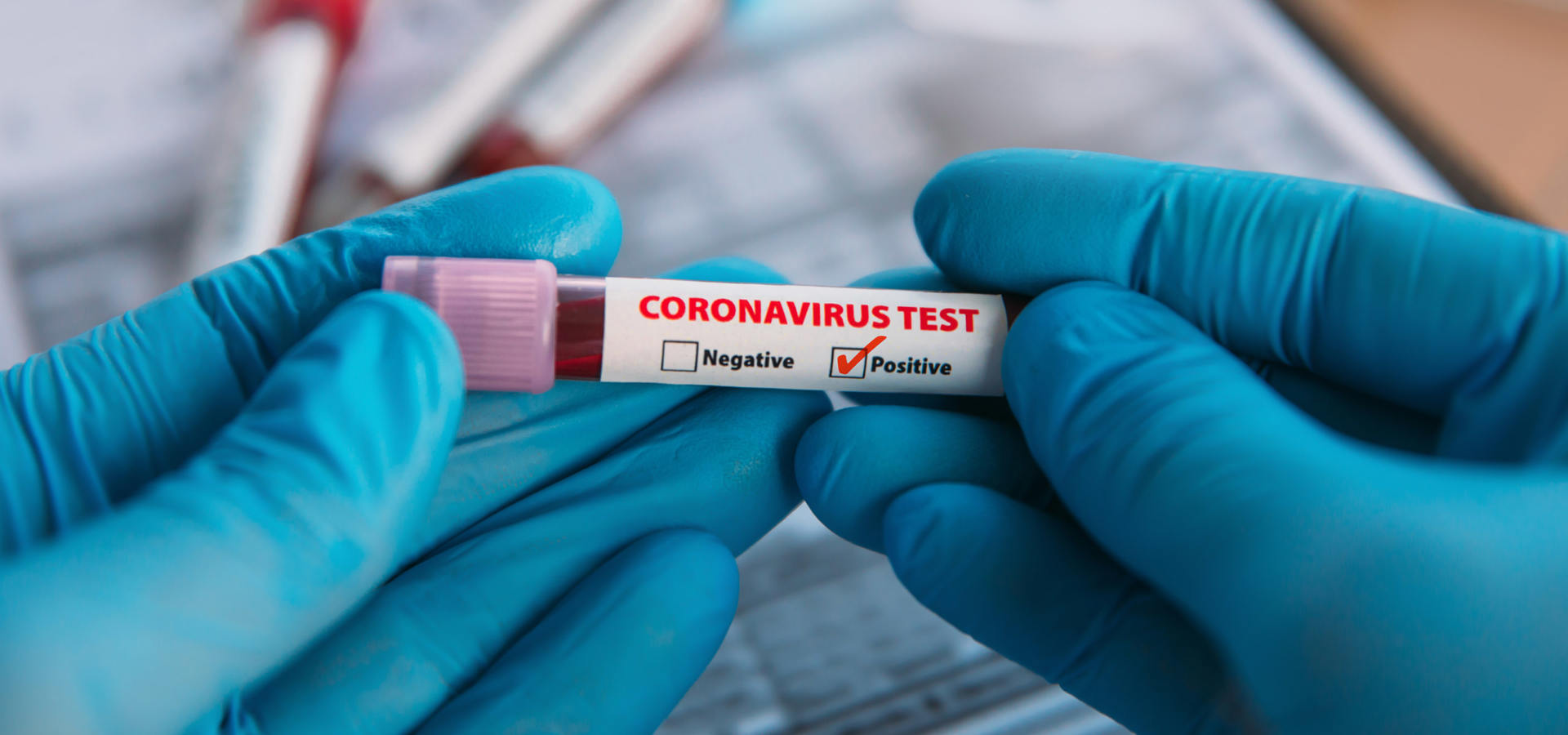 Coronavirus. In Abruzzo 24 nuovi casi, tra cui un bambino di due anni